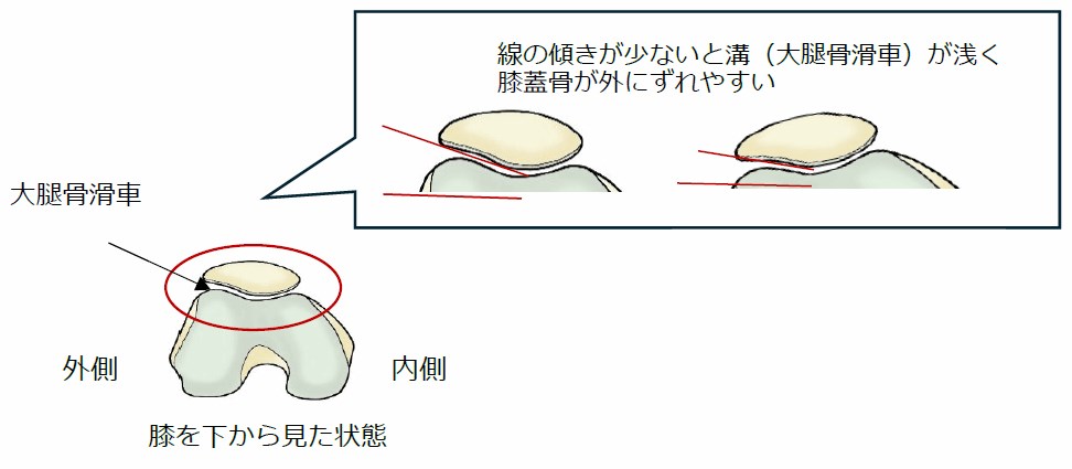 先天的な骨の形状