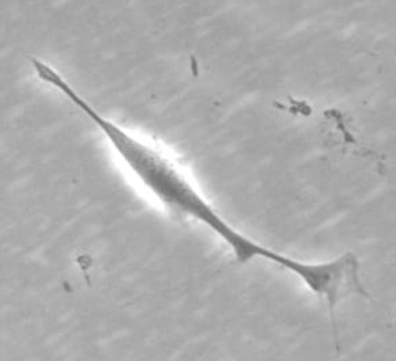 1個の脂肪幹細胞