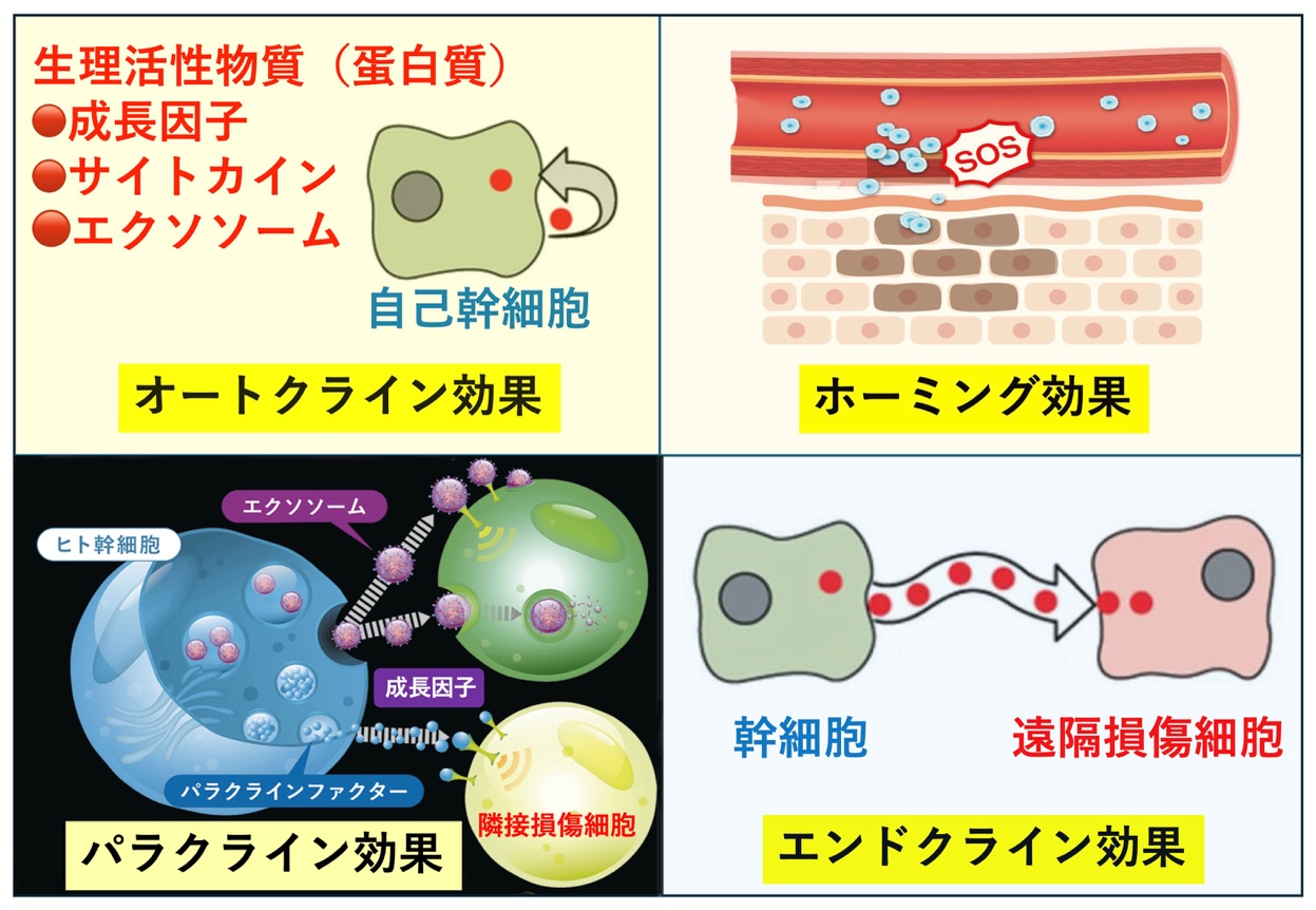 幹細胞は損傷細胞をどのようにして修復するか?
