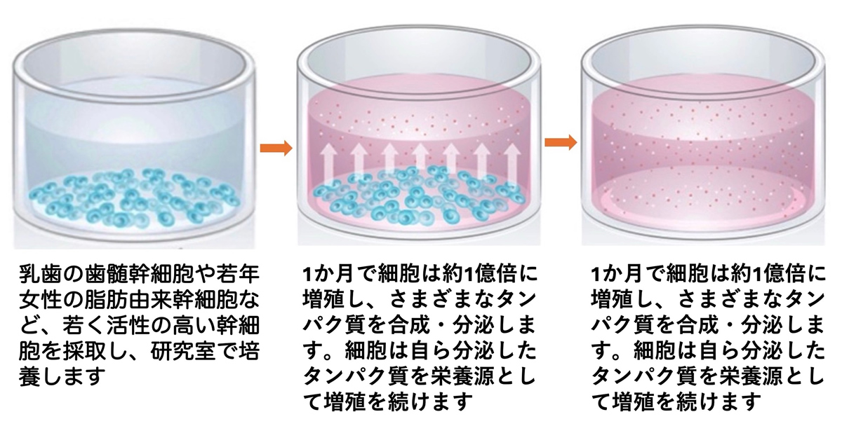 幹細胞培養上清液による簡便で安全な再生医療