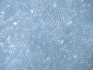 自己脂肪幹細胞