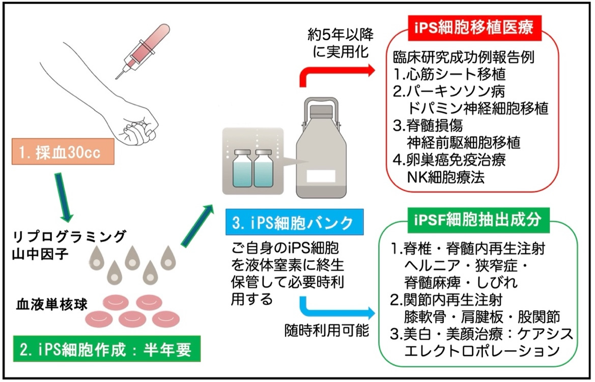 iPS細胞バンクを活用した個人向け臨床応用